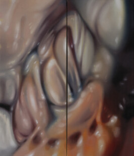 SCHMELZ (Diptychon/Diptych) Öl auf Leinwand /Oil on canvas 70 × 60 cm (70 × 30 cm jew./each) 2023 ©Anja Rausch 